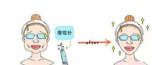 打注射瘦臉后臉真變小了，看來注射瘦臉真如傳聞所言