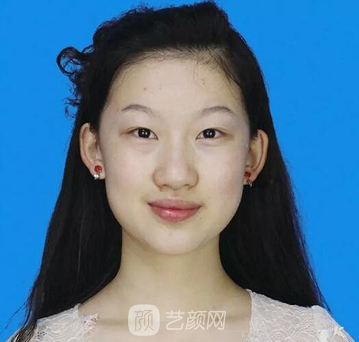 鄭裕錫歐巴駕到：扇形&平行如何選？