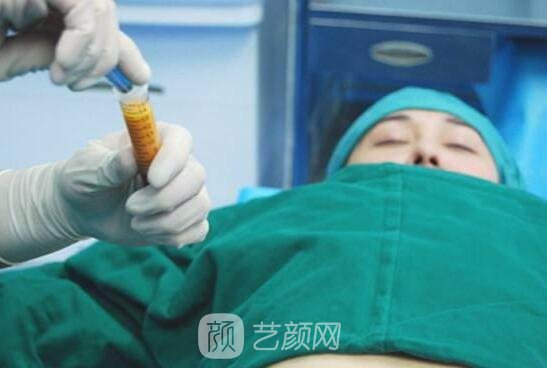 廉紅偉在水動力吸脂方面有著嫻熟的手法，他的方法對身體傷害極小