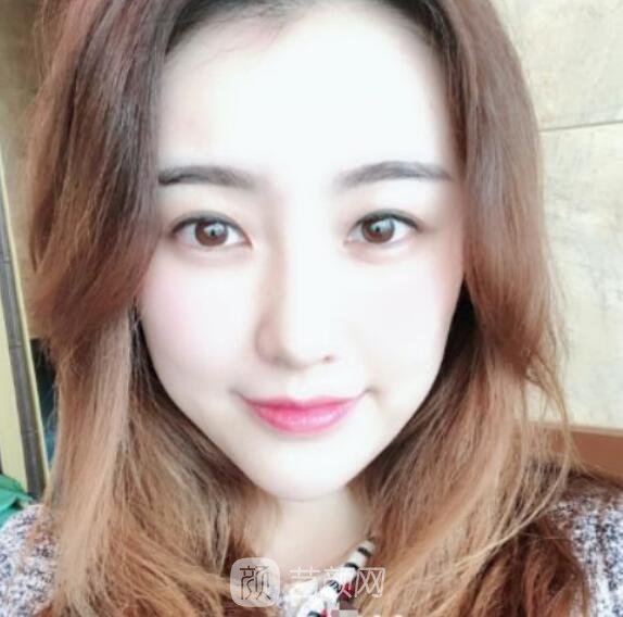 總體消化吸收的十分較為好，看上去看起來(lái)自身更年輕