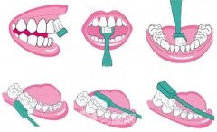 開講啦！種植牙護(hù)理大課堂鼓樓專場(chǎng)，上門就送598元大禮包！