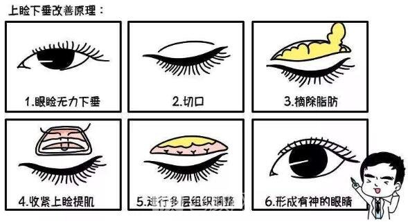  【眼部手術(shù)手術(shù)】九院眼部手術(shù)手術(shù)哪位醫(yī)生做的好？