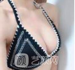 價(jià)錢要看胸部的不成功狀況