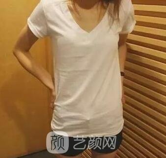 影響隆胸價(jià)格的要素有什么?