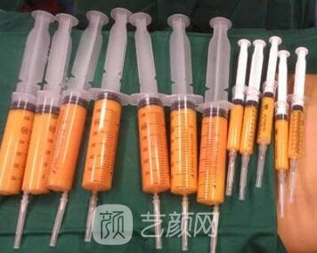 假體豐胸挑選哪些原材料好?