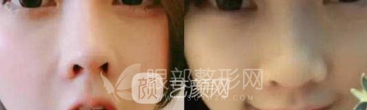 斗魚第一女主播馮提莫的進(jìn)化史：從素人到網(wǎng)紅！