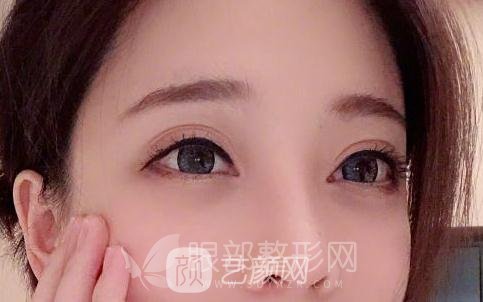 斗魚第一女主播馮提莫的進(jìn)化史：從素人到網(wǎng)紅！