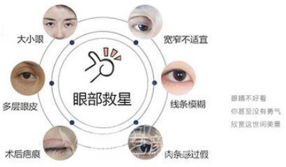 北京做雙眼皮手術(shù)哪里比較好