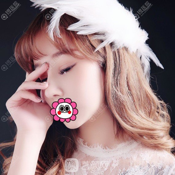 北京畫美于智宏自體肋軟骨隆鼻案例