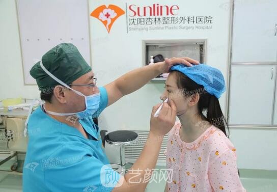 沈陽杏林張宇夫鼻部手術案例