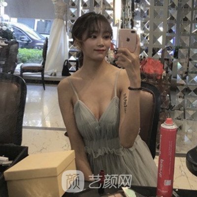 長沙劉超峰醫(yī)生做鼻修復(fù)怎么樣？2022招牌案例公布