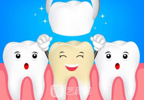 威蘭德臻瓷全瓷牙多少錢