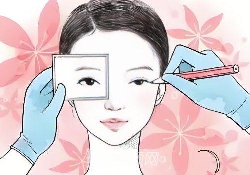 唐山做雙眼皮手術(shù)多少錢(qián)