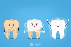 士卓曼種植牙體有國產(chǎn)的