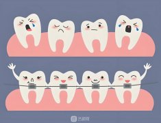 士卓曼種牙等級(jí)，分為三