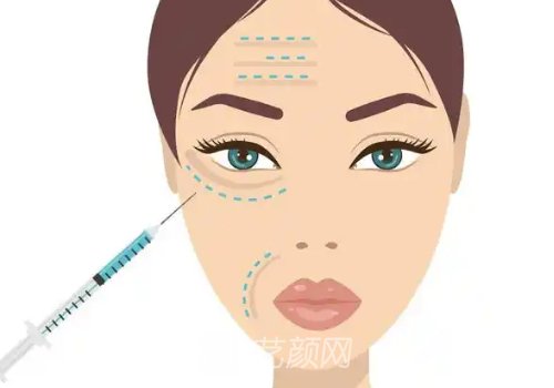 舒緹雅骨膠原價格是多少