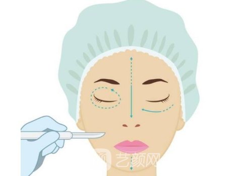 舒緹雅骨膠原是進(jìn)口還是