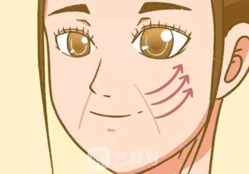 芙洛拉水光針功效和作用