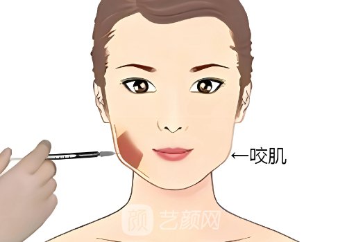 英倫大提升多少錢?價(jià)格及