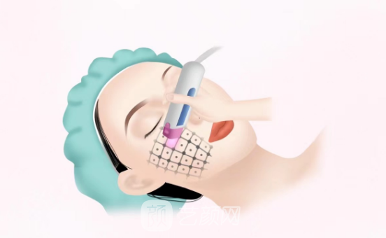 金達(dá)威聚拉美價(jià)格貴嗎?能