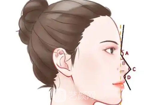 廈門隆鼻手術(shù)多少錢?因材